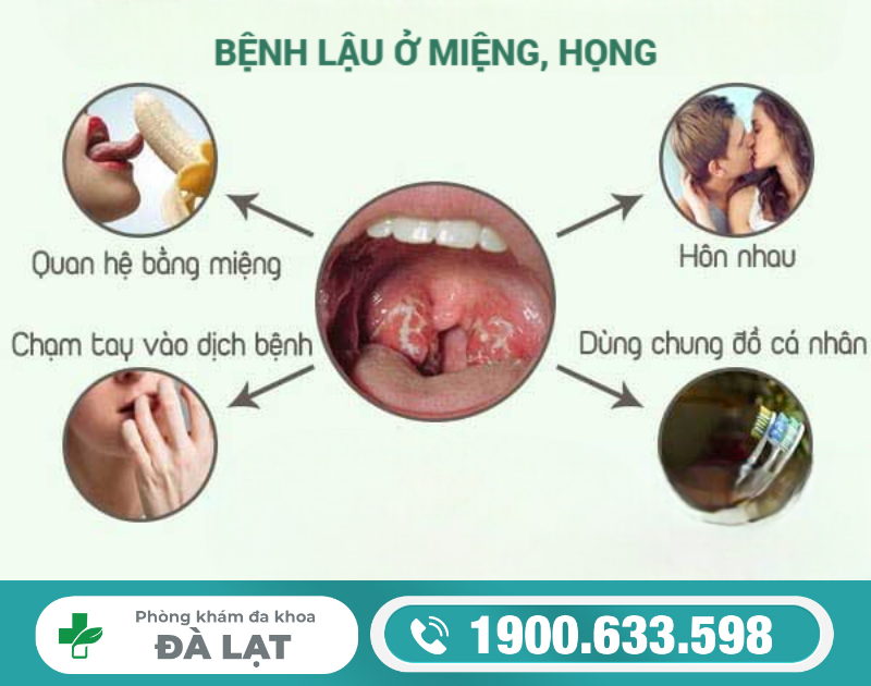 Hình ảnh minh họa